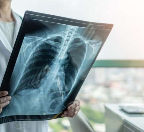 Vərəmə niyə kişilər daha çox yoluxur? 