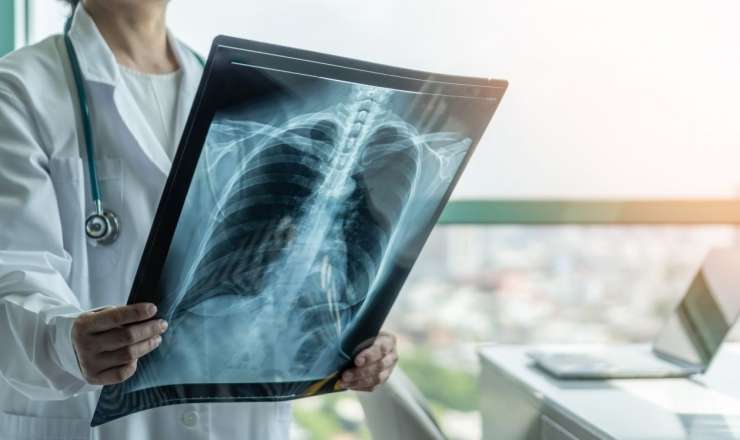 Vərəmə niyə kişilər daha çox yoluxur? 