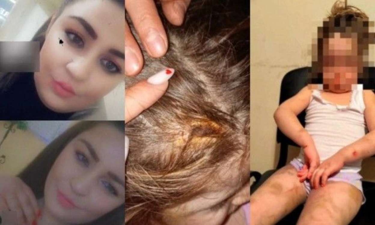 Bakıda ana 4 yaşlı qızına dəhşətli işgəncələr verdi: Kəmərlə döydü, bədənini yandırdı - TƏFƏRRÜAT 