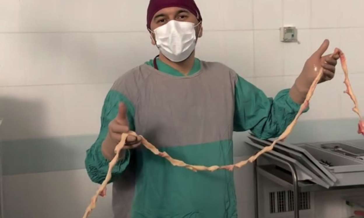 3,5 metr “kista” çıxarıldı – Dünyada ilk ola bilər - VİDEO