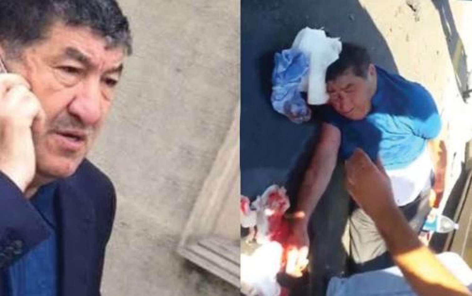 : Əməliyyat edə bilmirlər – XƏSTƏXANA DƏYİŞDİ Hacı Mazanın vəziyyəti ağırlışdı