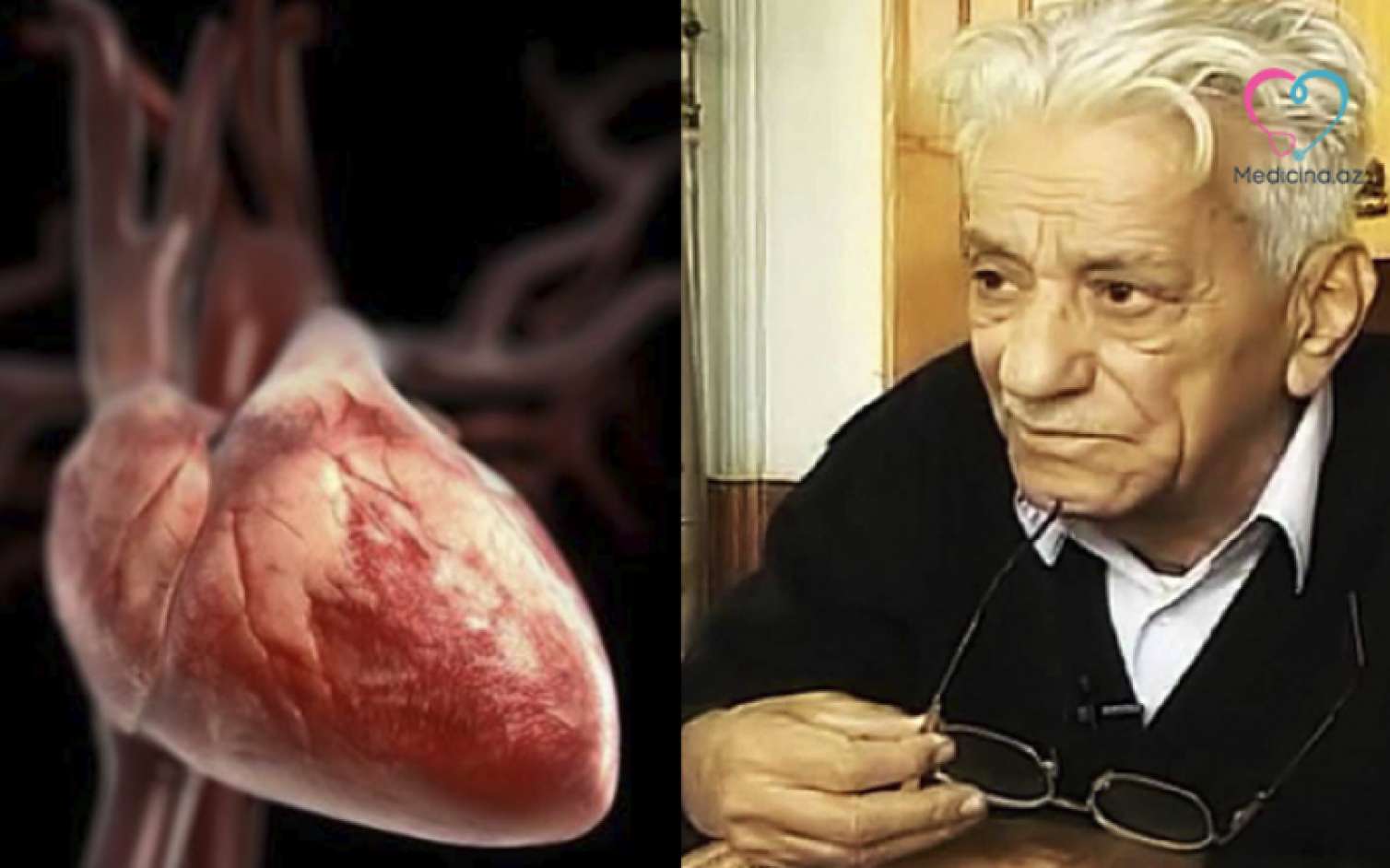 Ürəyi yerində olmayan şair –  Dekstrokardi nədir?