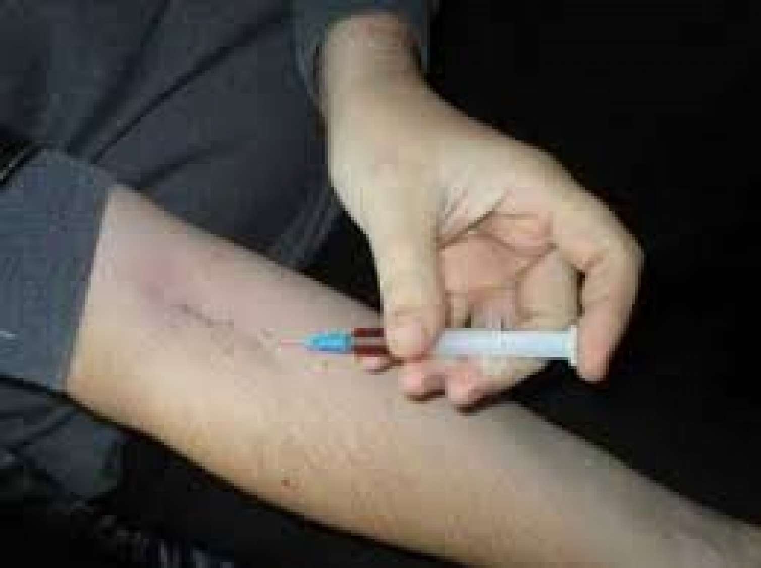 Orta yaşlı kişi yüksək dozada narkotikdən öldü 
