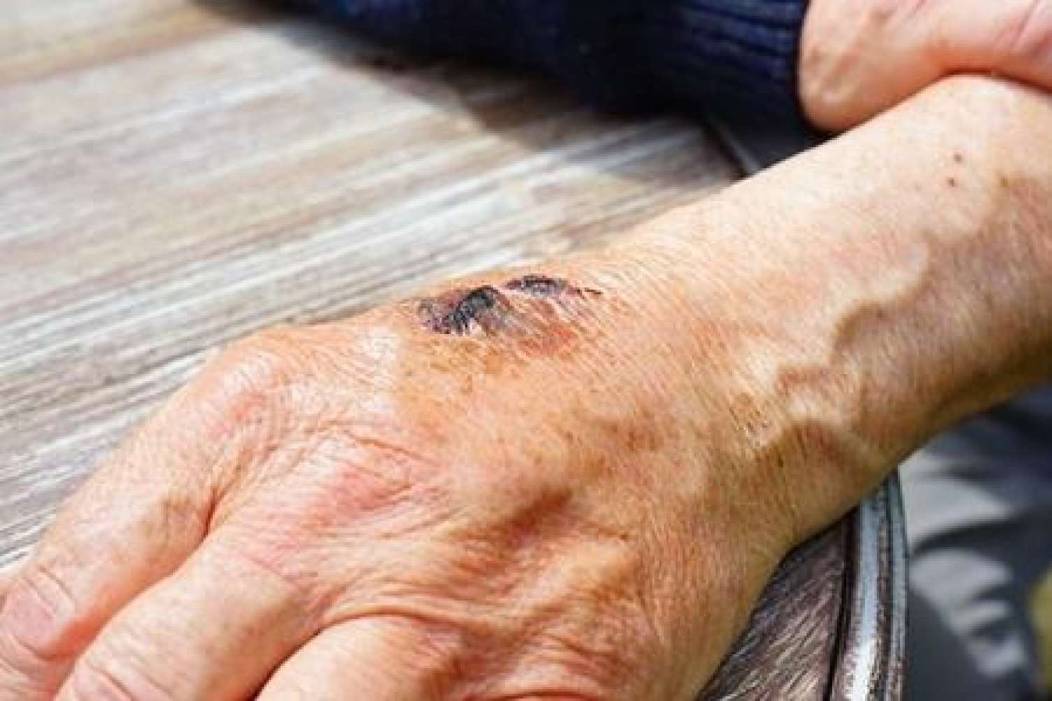 Qarayaraya yoluxanlardan xəbər var -  Rəsmi