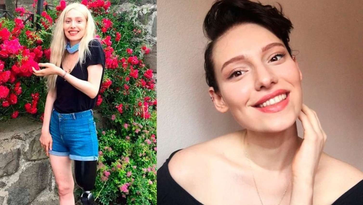  Xərçəngə qalib gələn qızın vəziyyəti ağırlaşdı   – Bütün Türkiyə ona dua edir - FOTO