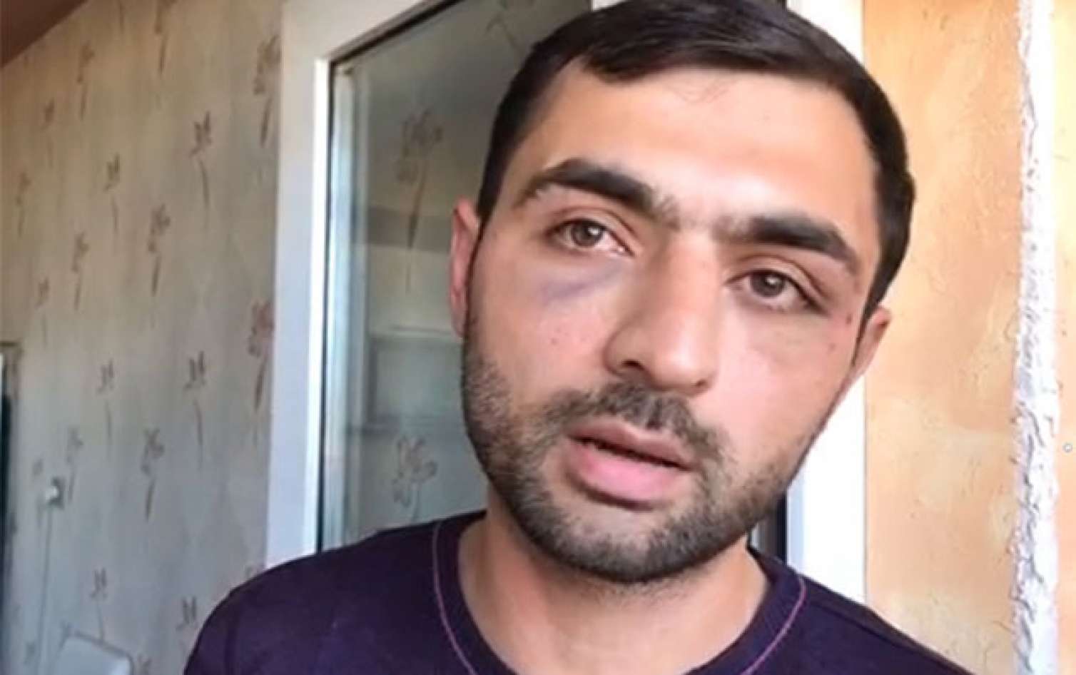 Bu gün azadlığa buraxılan Yasamal sakini Prezidentə müraciət etdi  "Məni 5 saat döydülər" - VİDEO