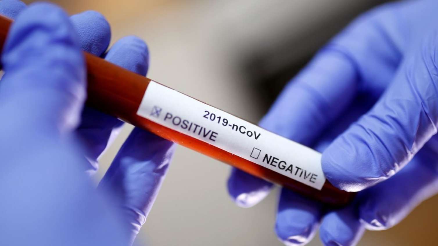 Füzulidə koronavirus xəstəsinə cinayət işi açıldı  