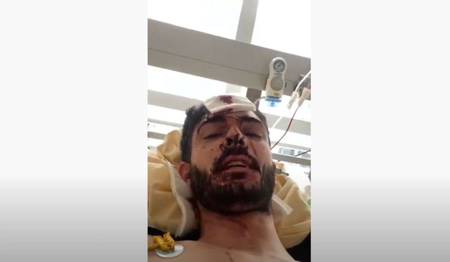 Təcili: Məhəmməd Mirzəlinin əllərini, ağzını doğradılar - Video 