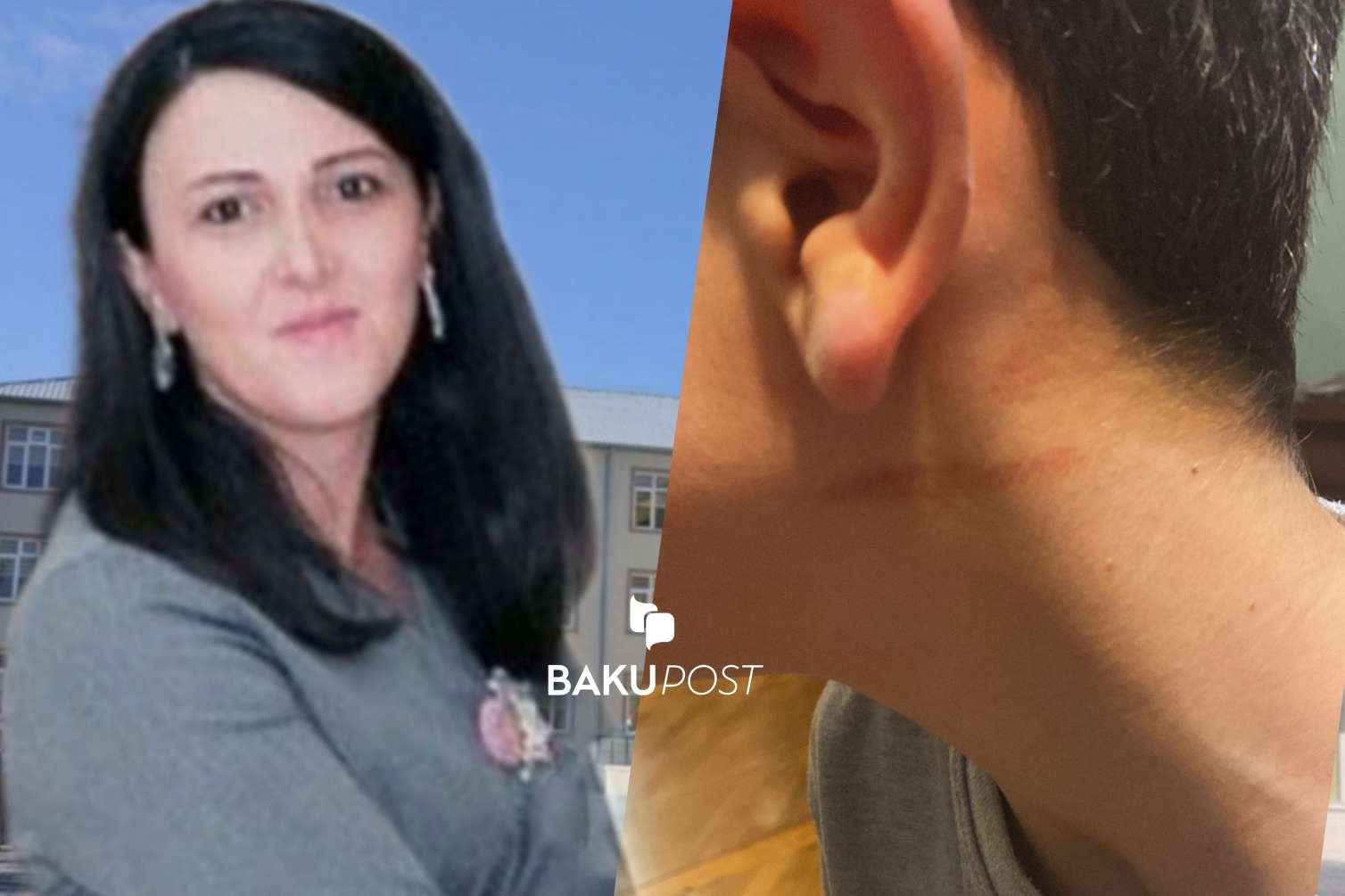 Məktəb direktoru şagirdi döydü - FOTO  