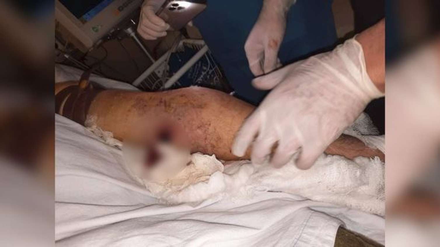 Ermənilər Ağdamı atəşə tutdu - "Bakcell"in əməkdaşı yaralandı -  YENİLƏNİB - FOTO