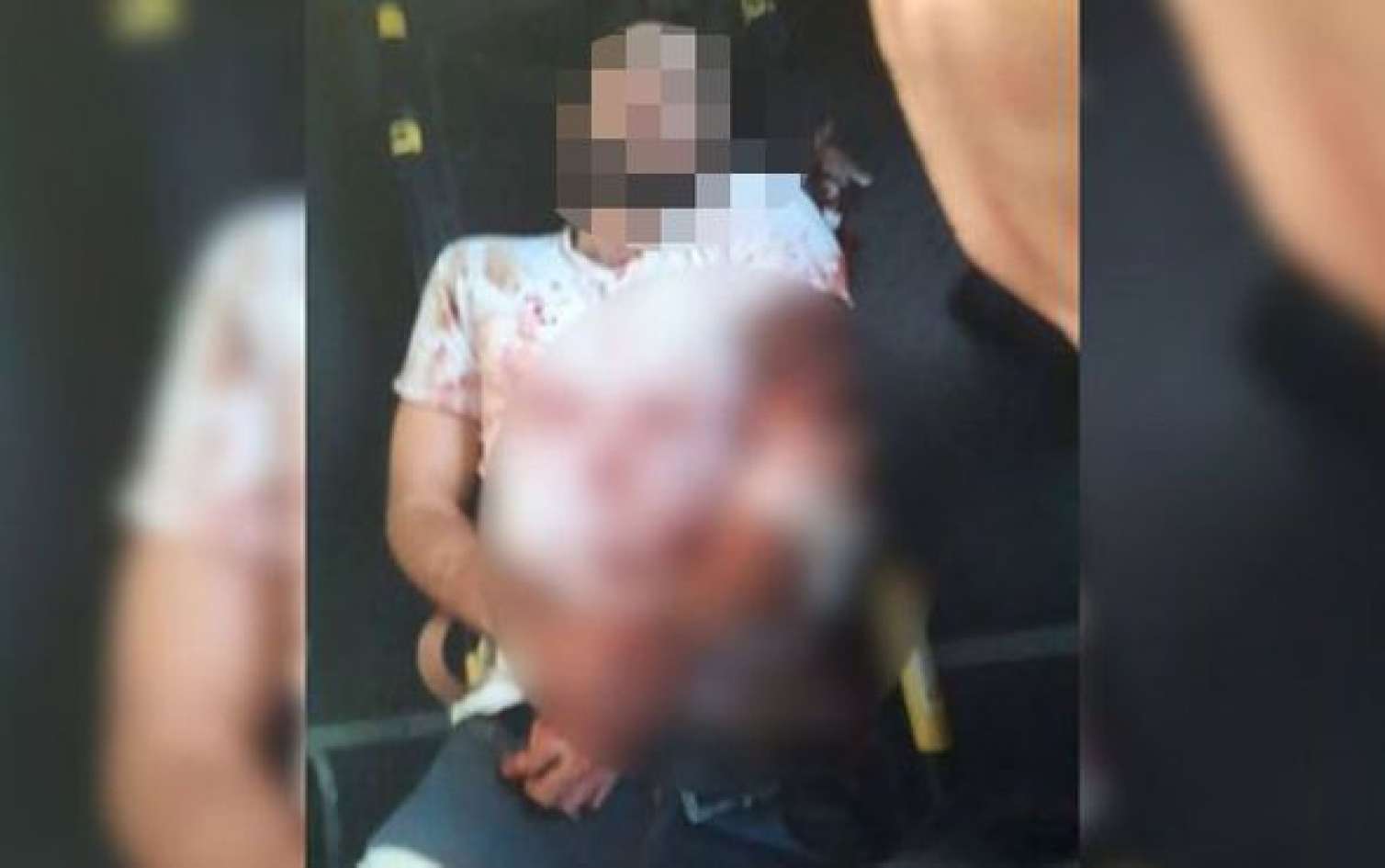 Ermənilər Ağdamı atəşə tutdu - "Bakcell"in əməkdaşı yaralandı -  YENİLƏNİB - FOTO