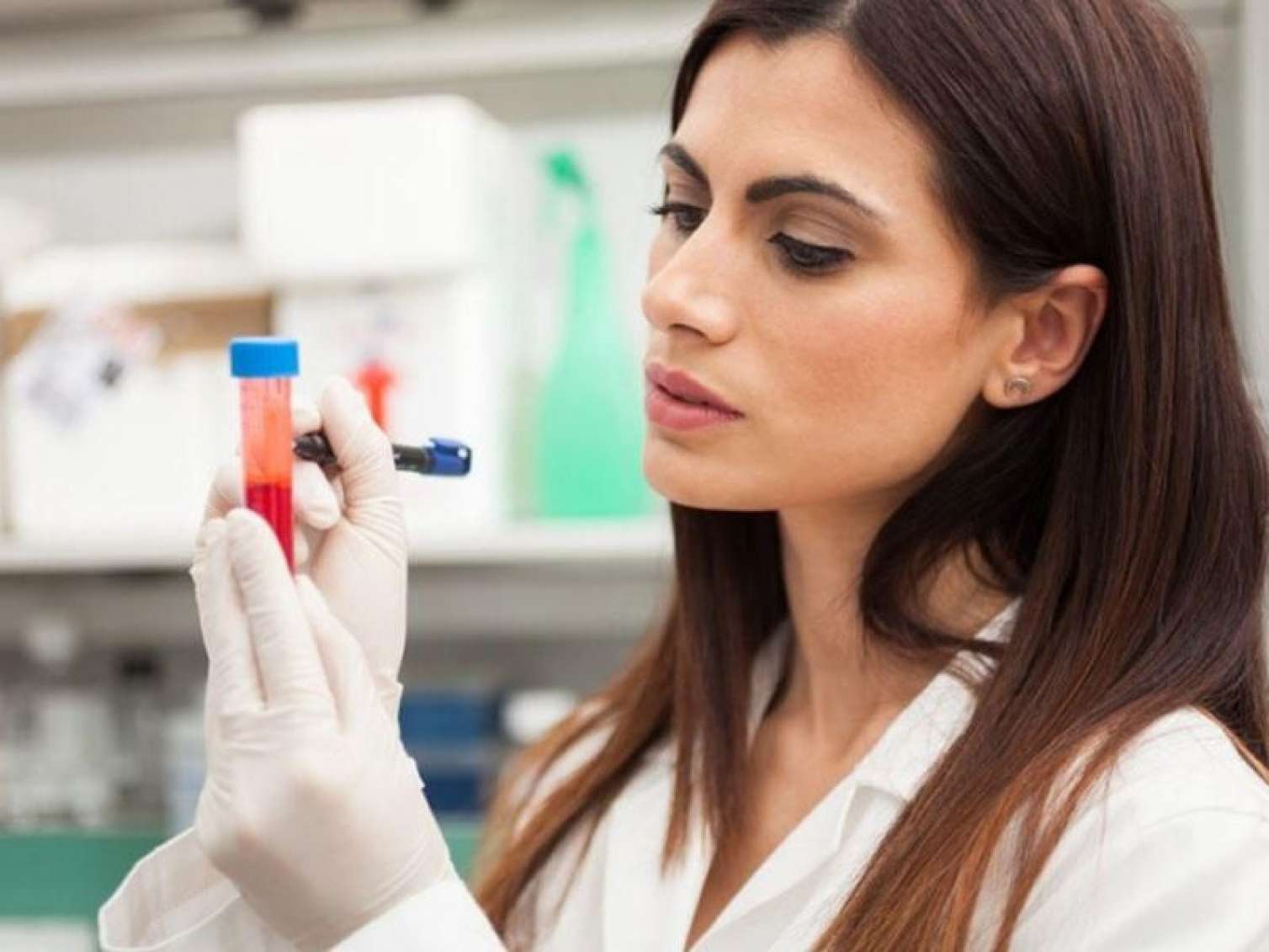 Qadınlar üçün ən vacib hormonal analizlər - TSH, T3, T4… 