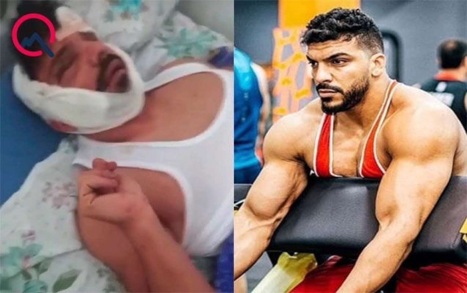 Partlayışda ağır yaralanan çempionun son halı -  FOTO