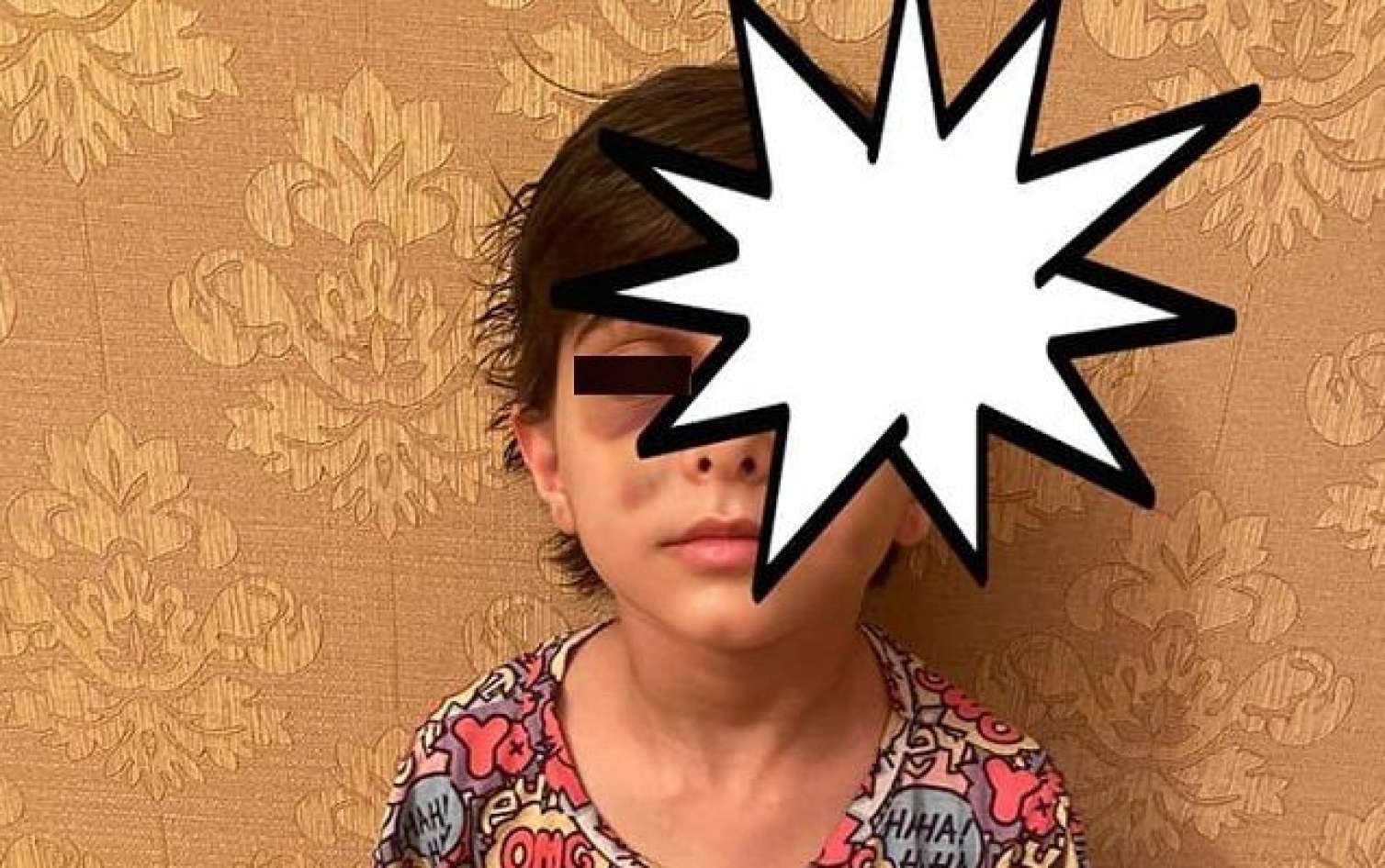 Sumqayıtda üç azyaşlı anasının sevgilisi tərəfindən döyüldü  