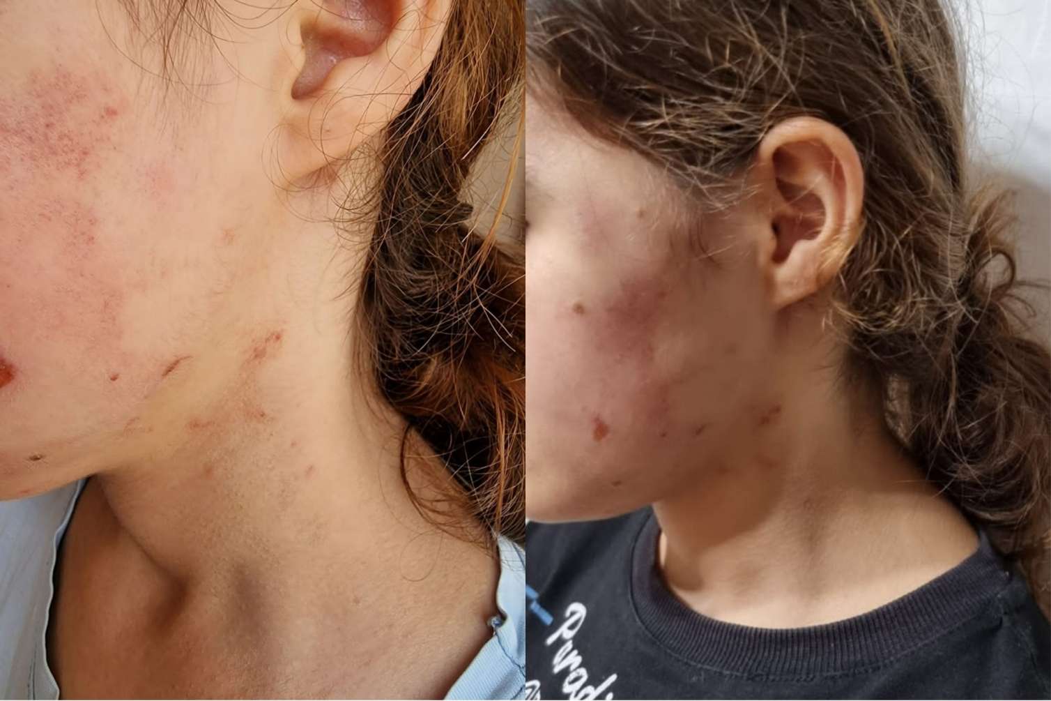 İcra başçısının müavini məktəbli qızı döydü - İDDİA - FOTO  
