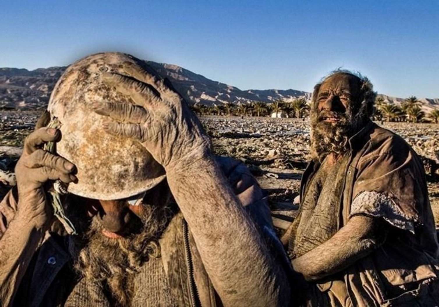 Dünyanın ən çirkli adamı 94 yaşında öldü -  FOTO