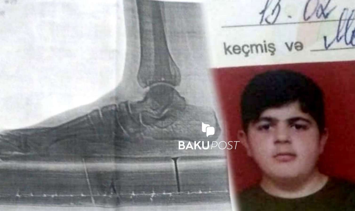 Hərbiyə yararsız adamı əsgər aparırlar – Mayor saxta sənəd düzəldib? - FOTO 