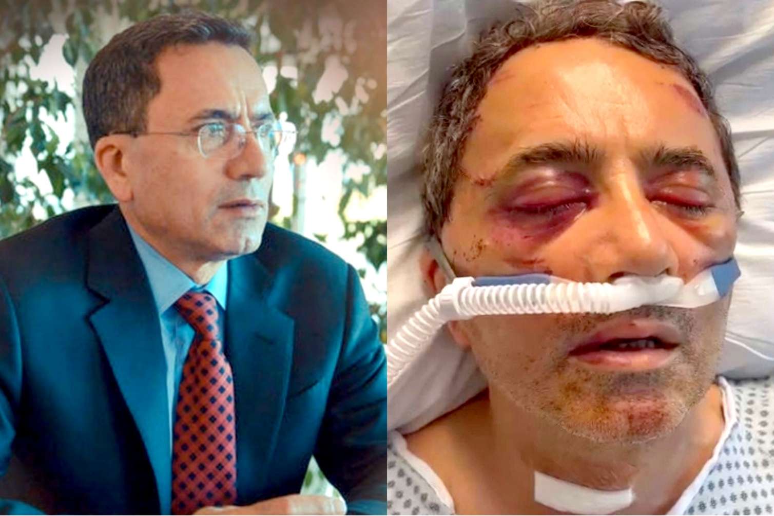 Əhməd Obalını və oğlu Dənizi ABŞ-da ölümcül döydülər -  VİDEO