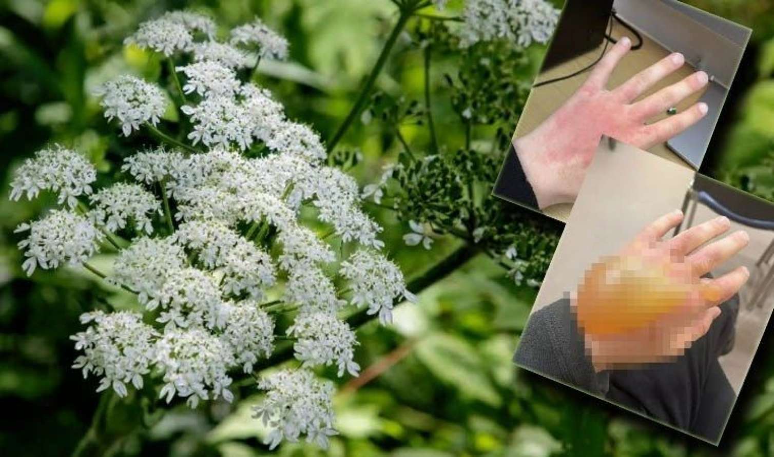 Dünyanın ən təhlükəli bitkisi - Dəhşətli ağrılara səbəb olur -  FOTO