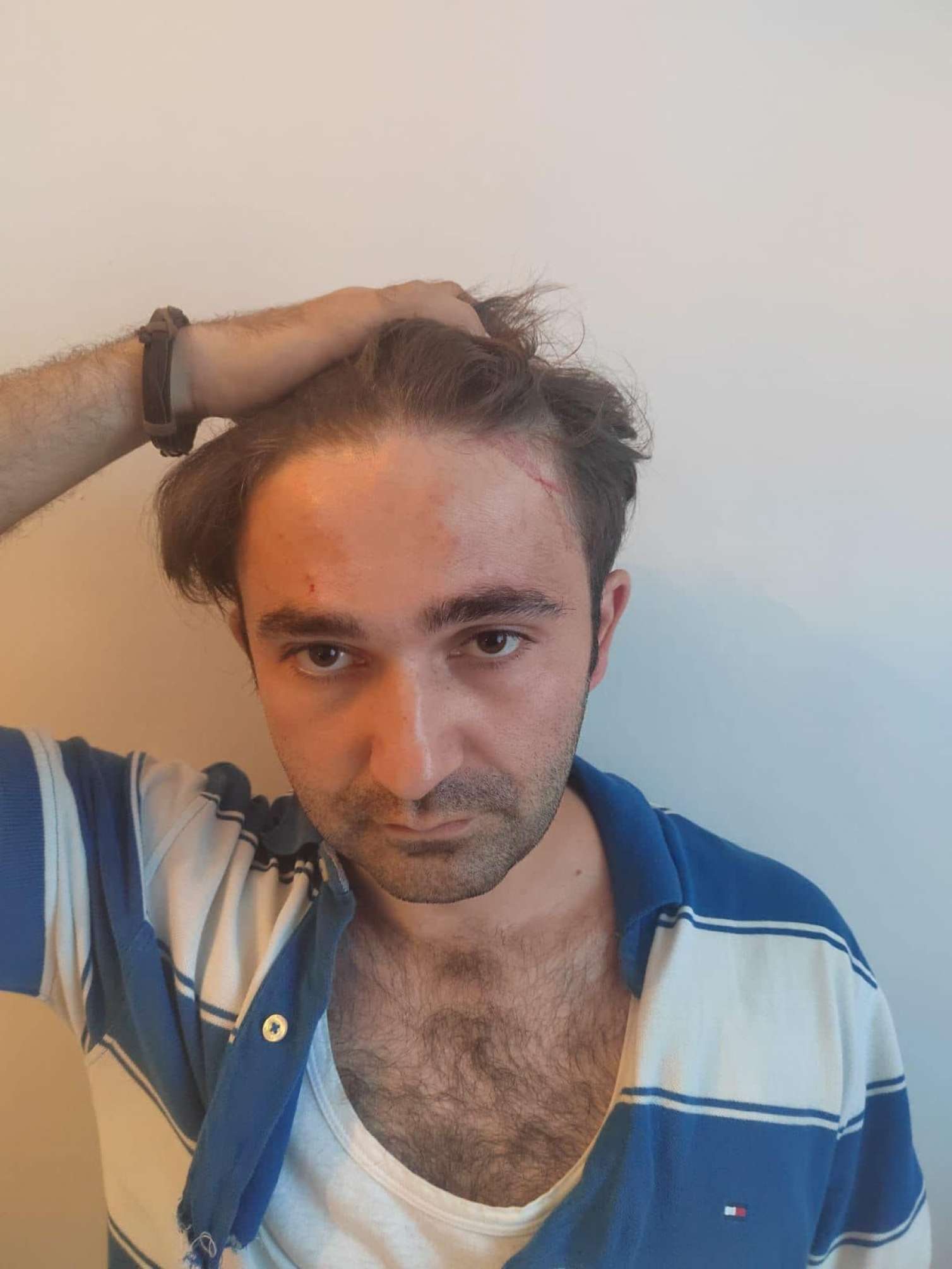 Vəfa Nağının şillələdiyi vəkili bu dəfə döydülər - FOTO 