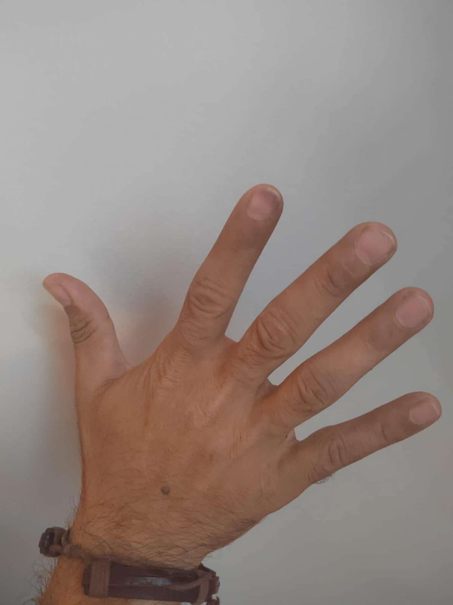 Vəfa Nağının şillələdiyi vəkili bu dəfə döydülər - FOTO 