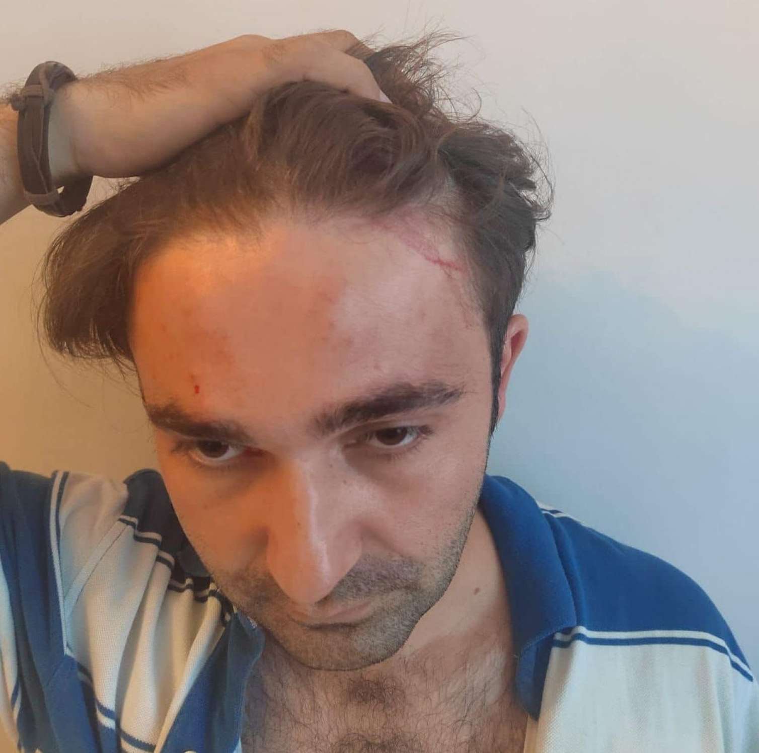 Vəfa Nağının şillələdiyi vəkili bu dəfə döydülər - FOTO 