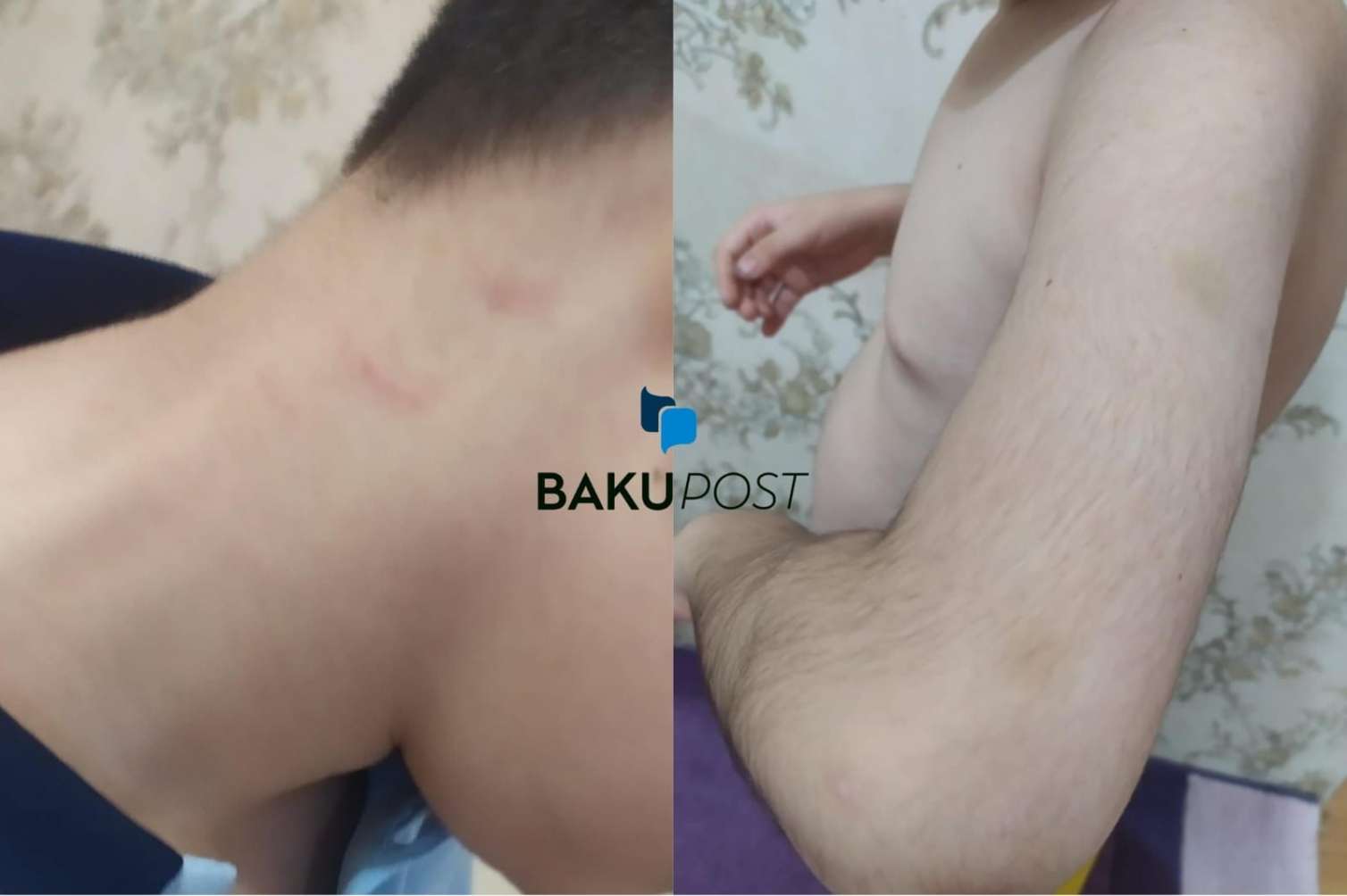 Məktəbdə fiziki zorakılıq: Bu dəfə müəllimin uşağı döyüldü - FOTO+YENİLƏNİB 