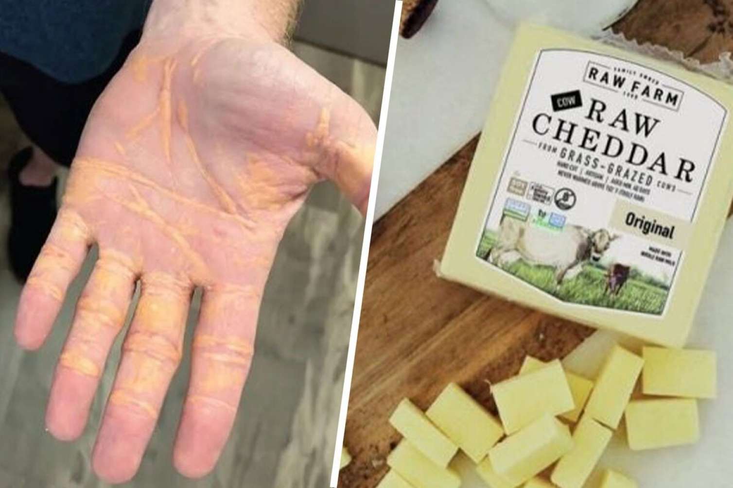 Gündə 4 kiloqram pendir yeyən kişi görün nə hala düşdü - FOTO