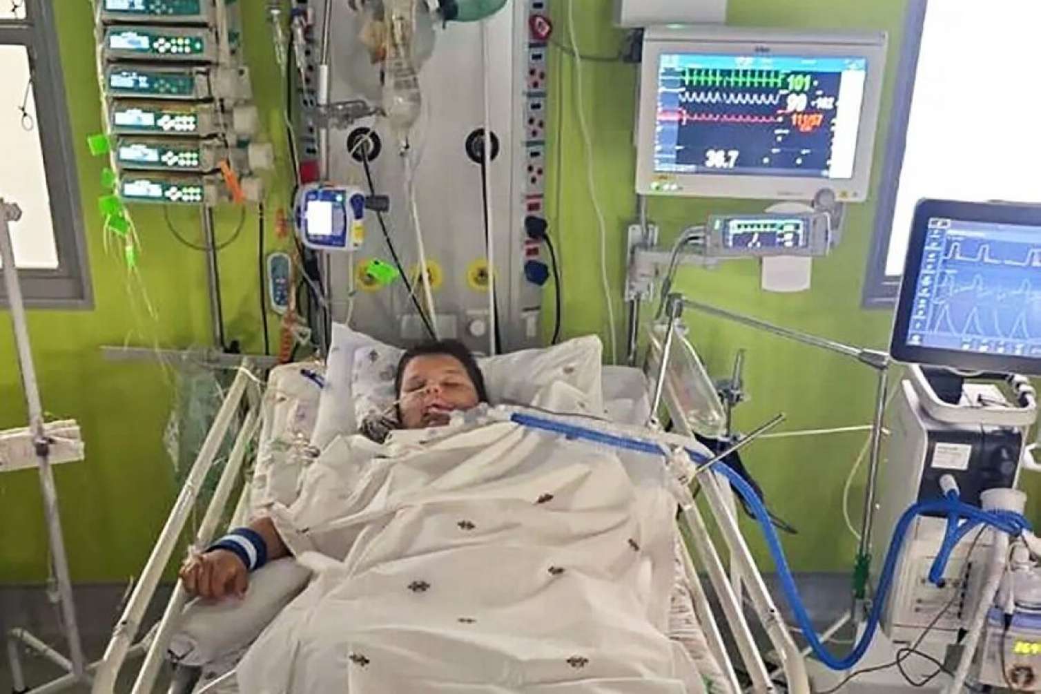 Timsah yeddi yaşlı uşağın qolunu qopardı 