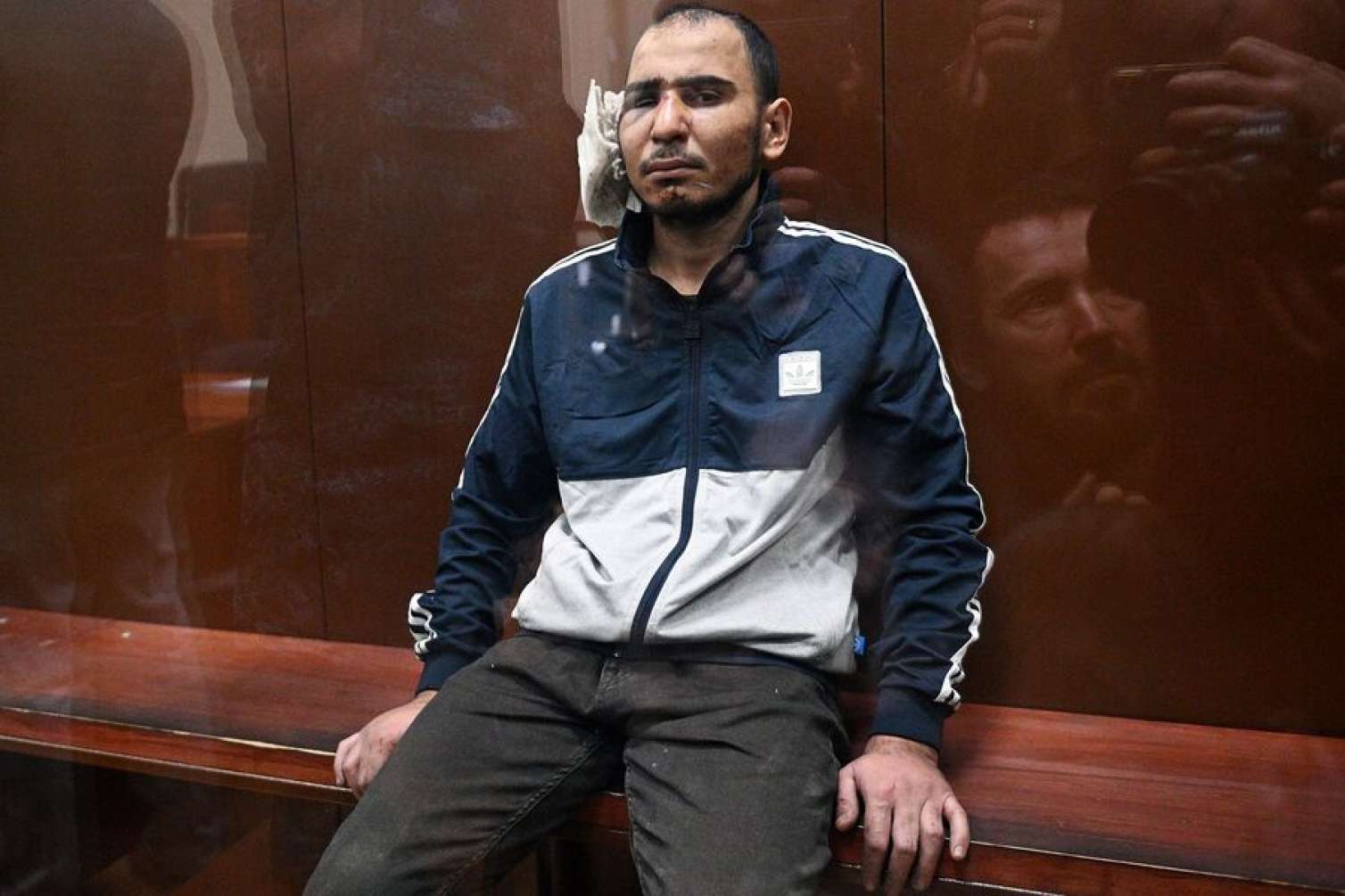 "Krokus Siti" terrorçusunun qulağını niyə kəsiblər? - İlginc səbəb 