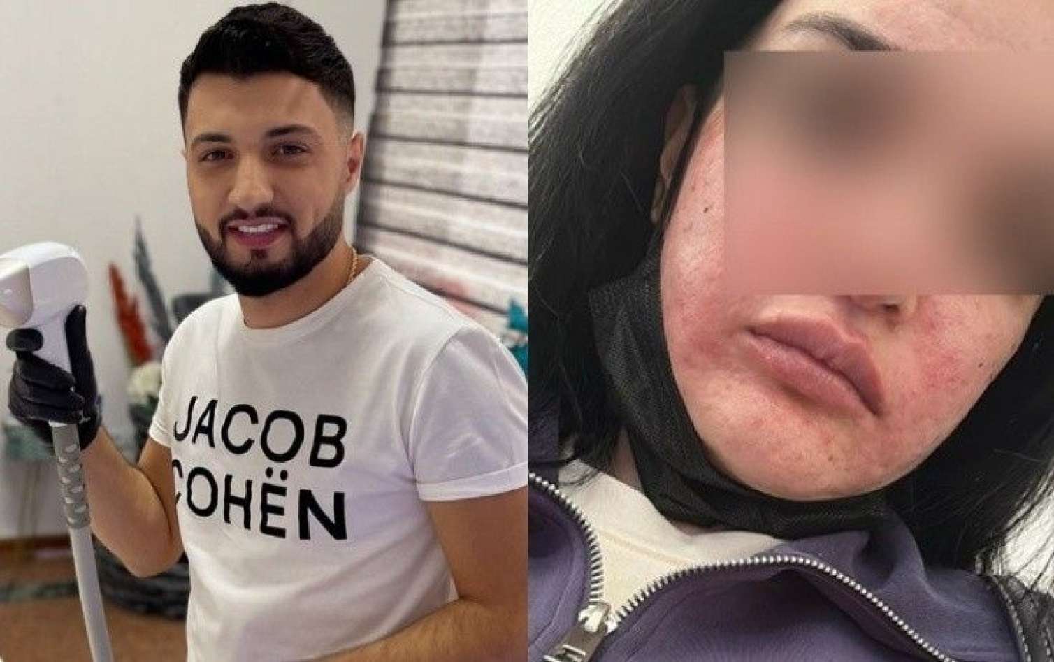 "Dedilər ki, üzümü bu hala qoyan Əmrah həkim yox, bərbərdir" 