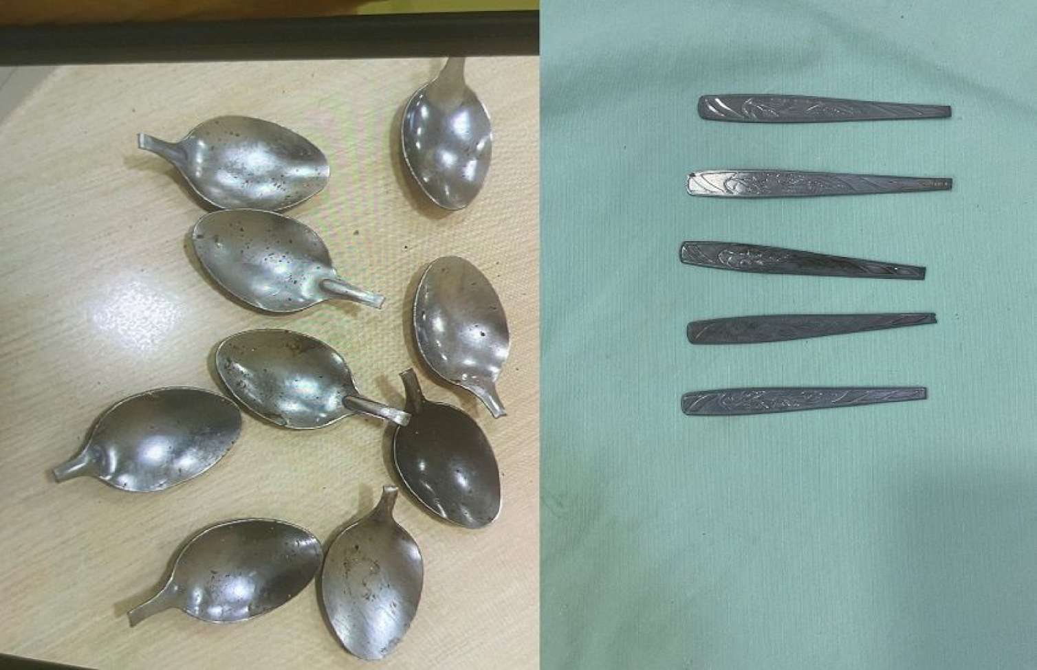 Bakıda 9 ədəd qaşıq udan şəxslə bağlı  YENİ DETALLAR