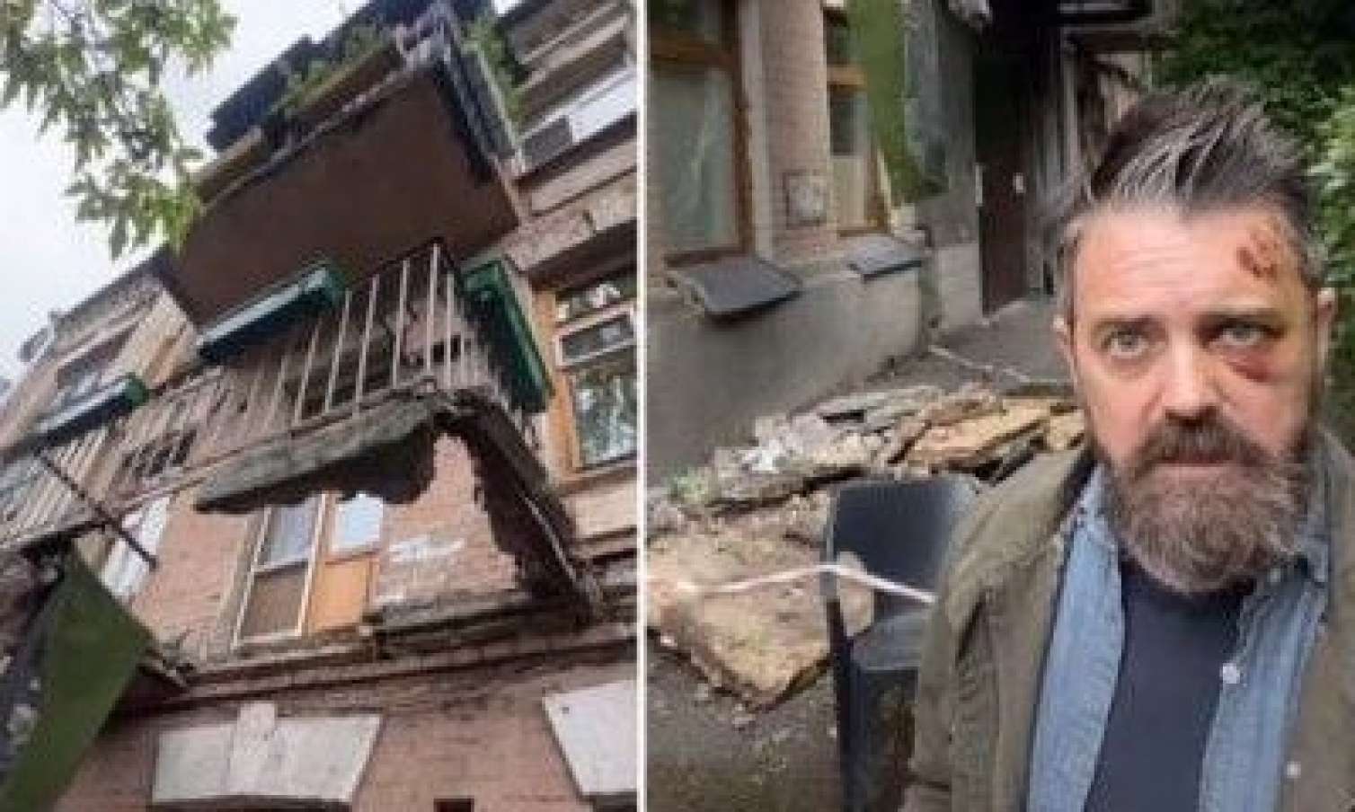 Kiyevdə məşhur amerikalının başına balkon düşdü - Foto 
