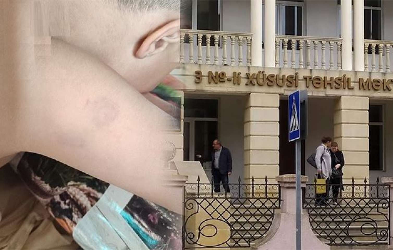 Müəllim autizmli uşağı DÖYDÜ -  Rəsmi AÇIQLAMA - FOTO