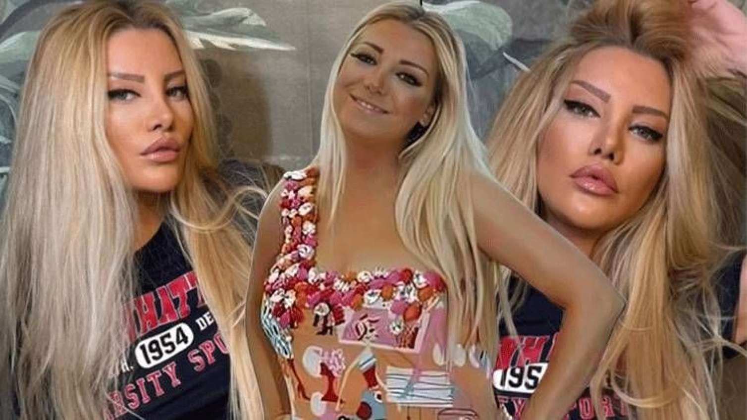 Əməliyyatla dəyişən modelyeri aeroport sistemi də tanımadı 
