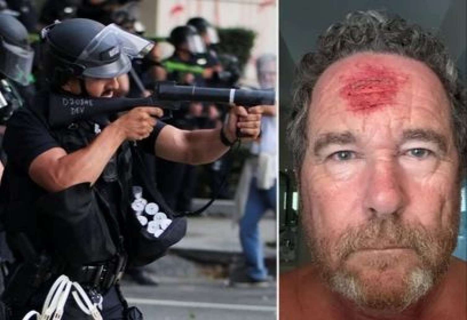 Los-Ancelesdə polis jurnalisti güllələdi - FOTO 