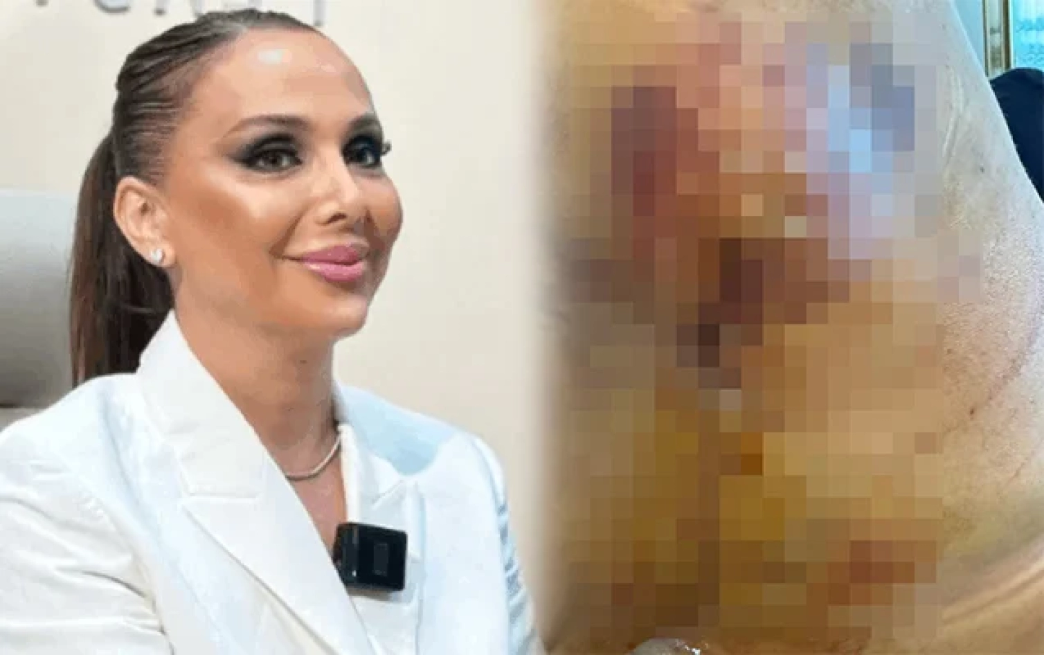 “Həkim məni 3 dəfə əməliyyat edib pis vəziyyətə qoydu” - Daha bir məşhur cərrahdan ŞİKAYƏT