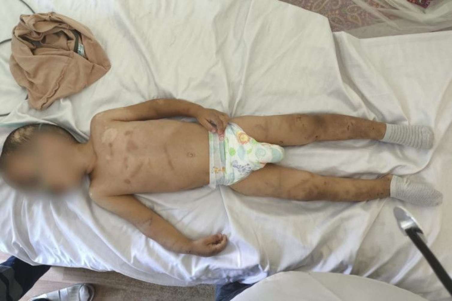 Valideynlərinin zorakılıq etdiyi uşağın son durumu 