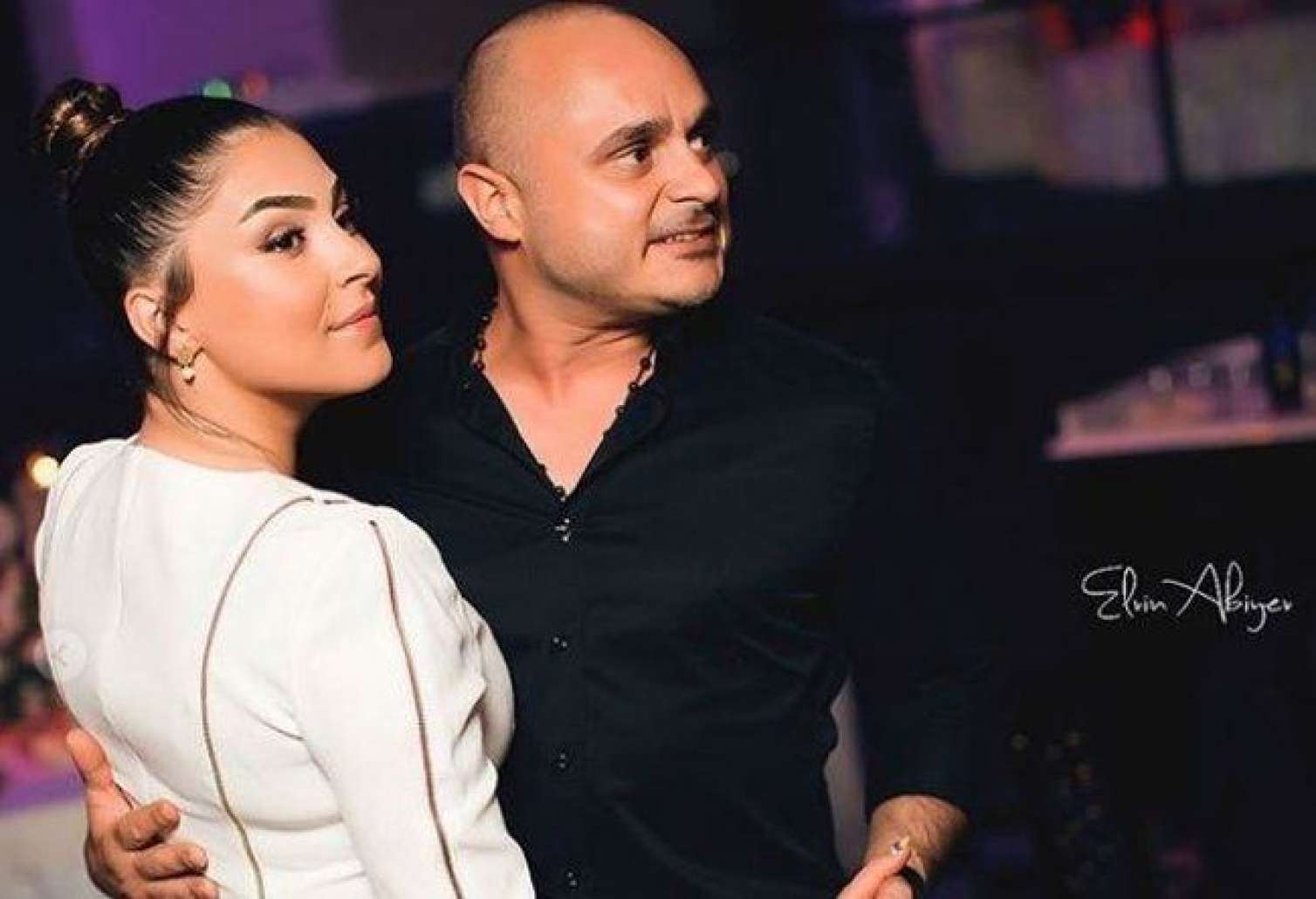 Miri Yusifin həyat yoldaşını it dişlədi 