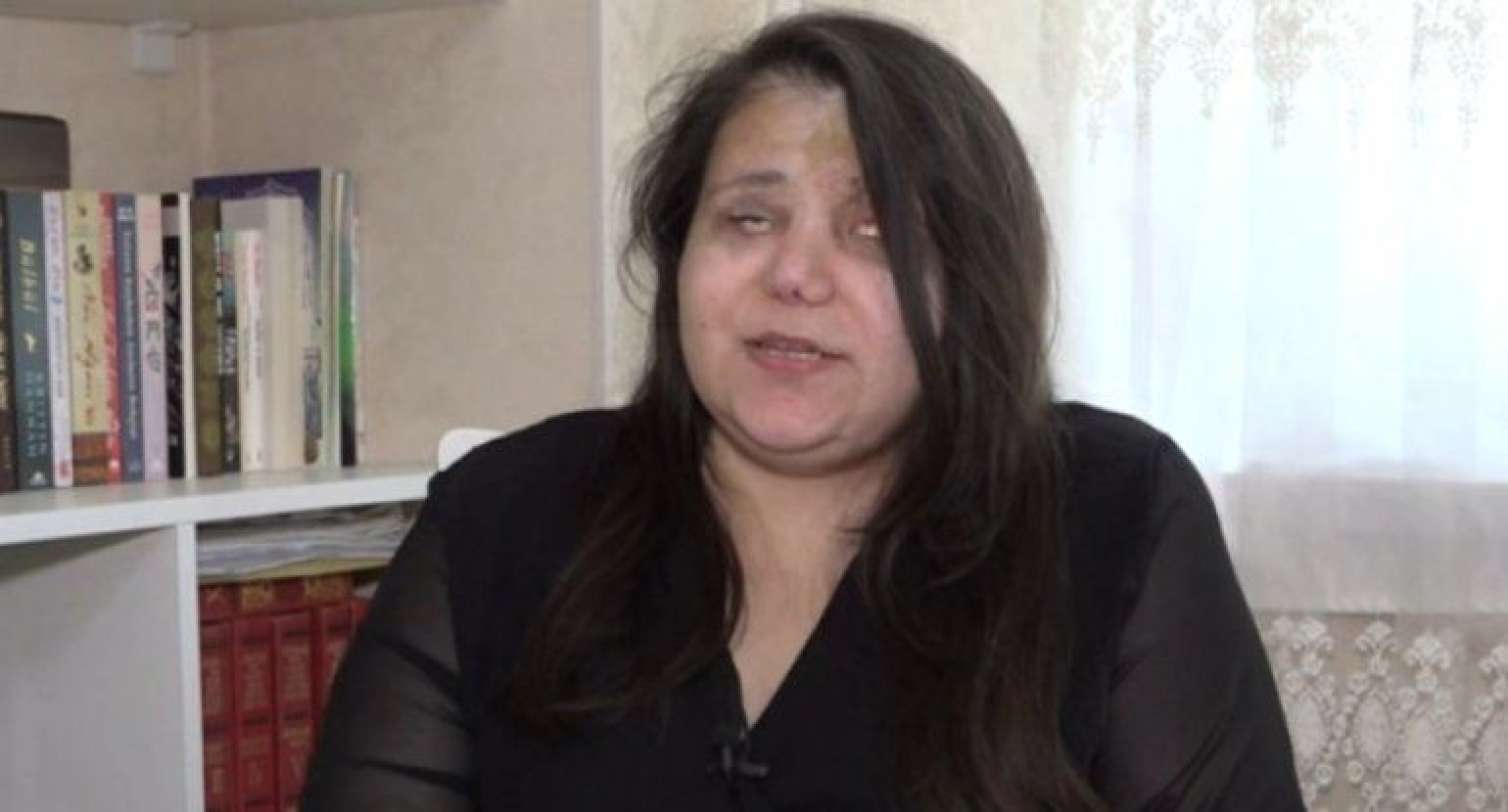 Gəncə terrorunda gözlərini itirən qadın: "Qoymayın ölüm, qızlarım var" - VİDEO 