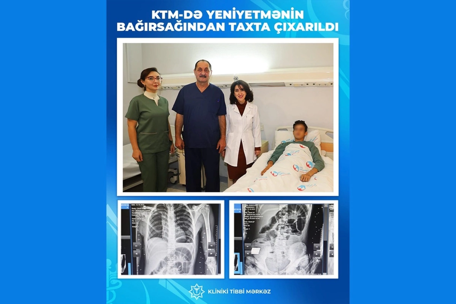 Bakıda 17 yaşlı gənc taxta parçaları uddu 