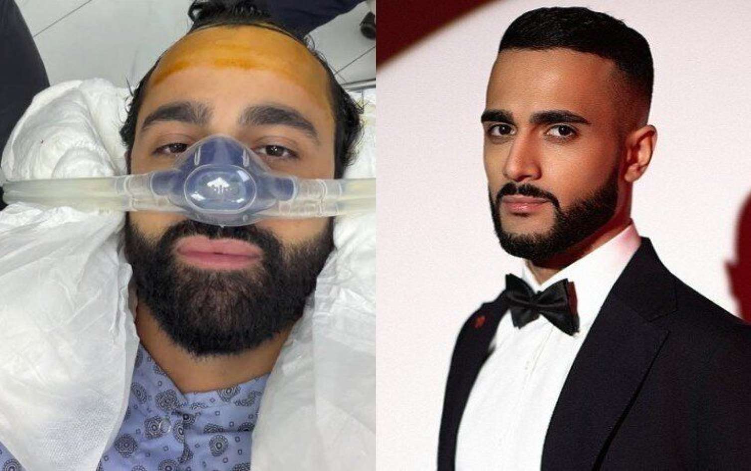 Hüseyn Həsənov tanınmaz halda - FOTO 