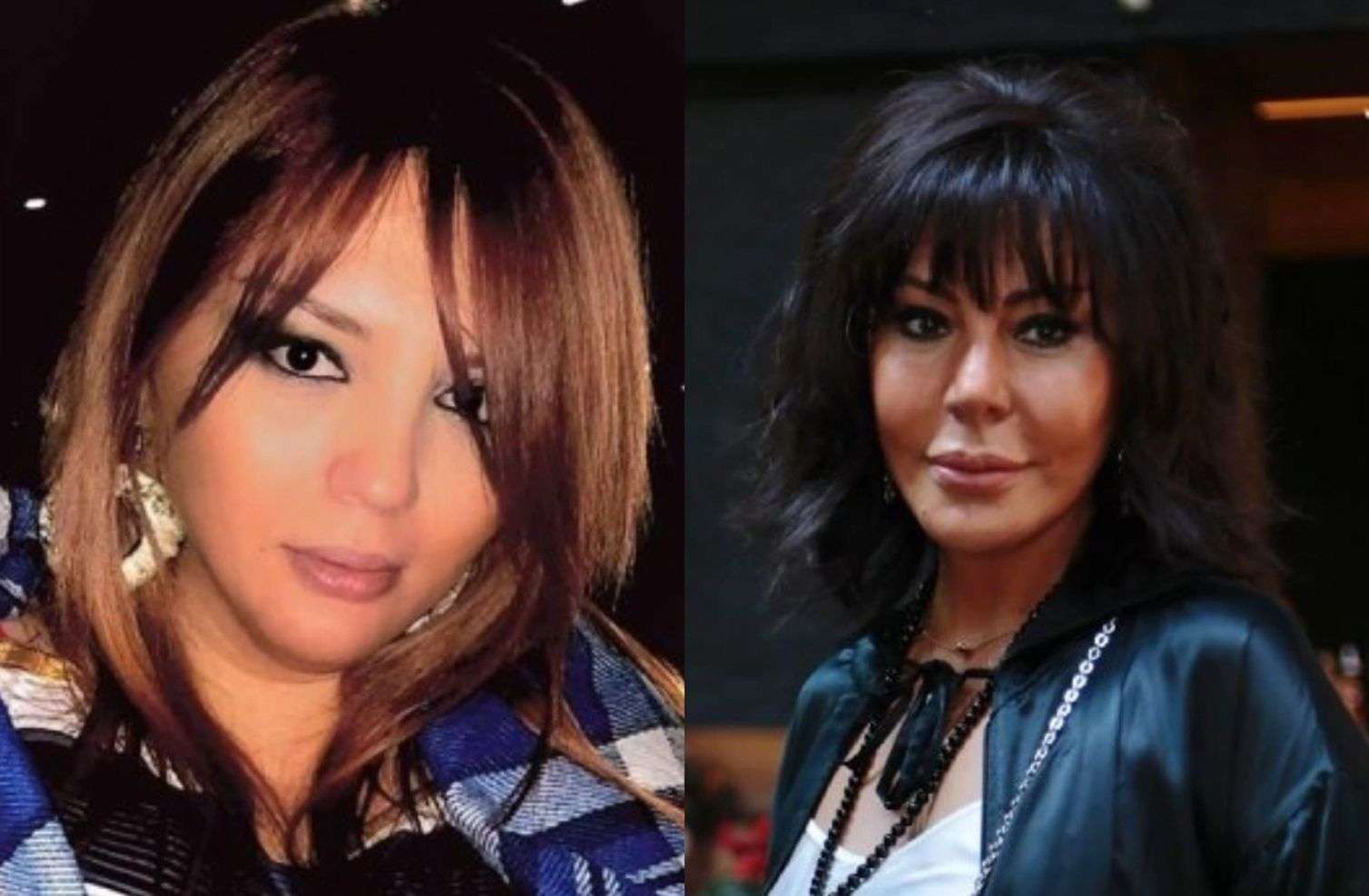 Əri müğənninin qabırğasını sındırıb? - "Həyatda hər şey ola bilər" – AÇIQLAMA 