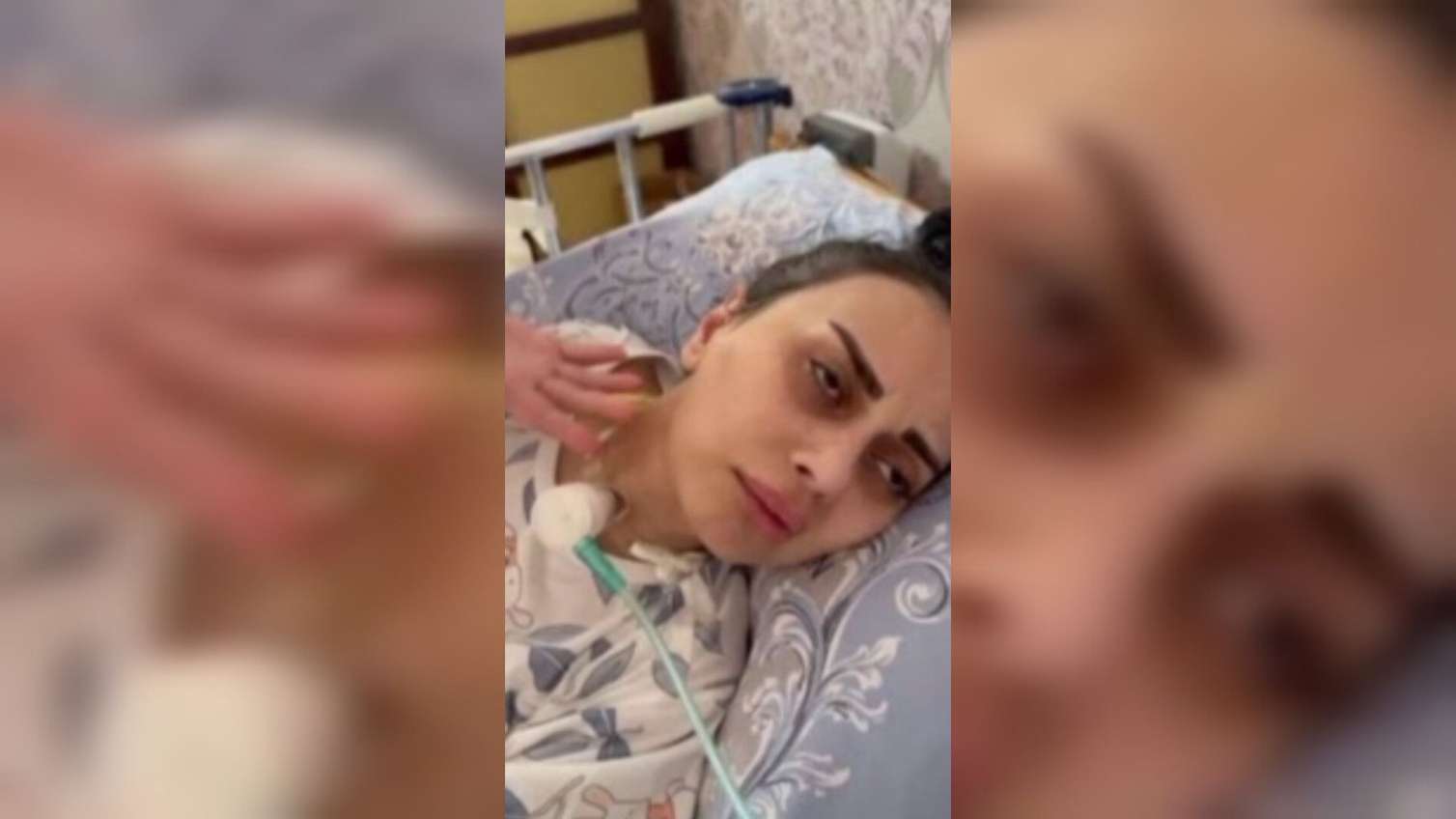 Bakıda gənc qız burun əməliyyatı zamanı kliniki ölüm keçirib - Altı aydır yataq xəstəsidir 