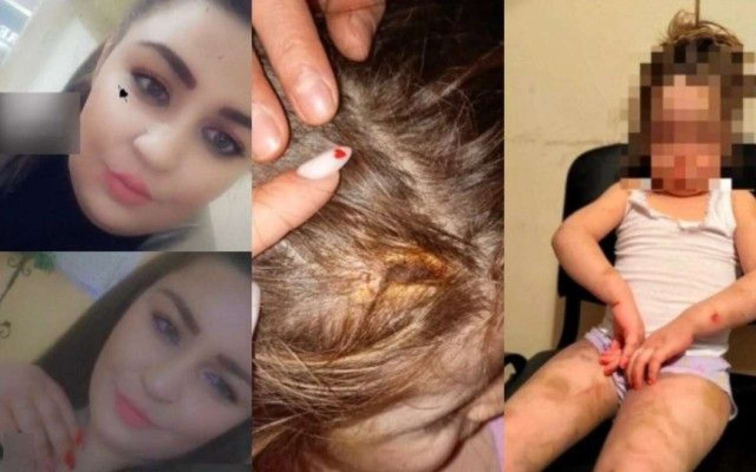 Bakıda ananın 4 yaşlı qızına verdiyi işgəncələr: Bədəni yandırılıb, kəmərlə döyülüb - TƏFƏRRÜAT 