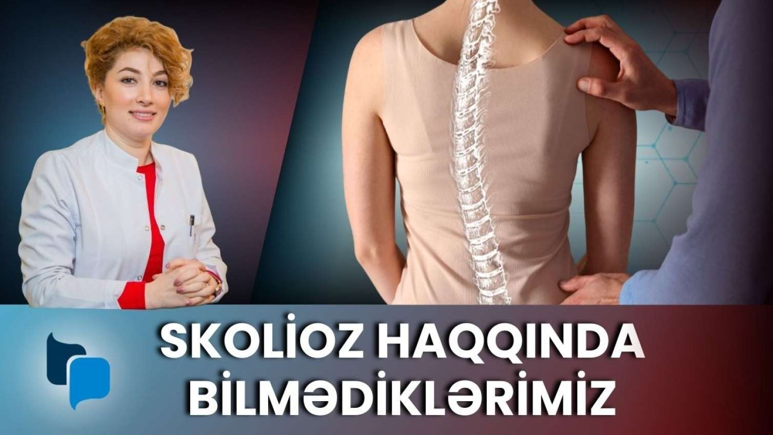30-50 yaşlarda yaranan skoliozlar və onun müalicəsi - Həkimlə müsahibə + VİDEO 