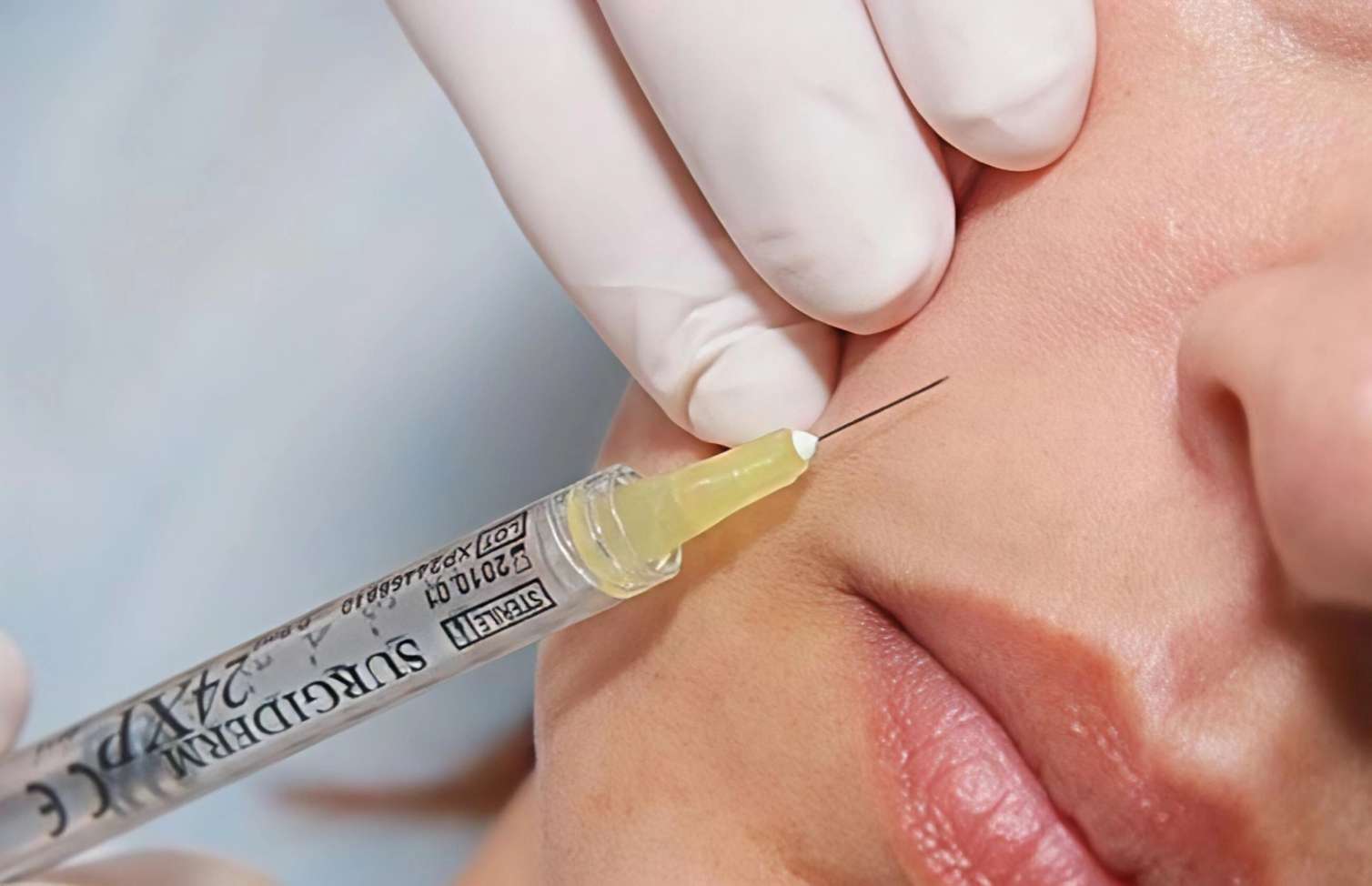 Üzünə dolğu etdirənlərə xəbərdarlıq: Toxuma itkisi və korluq yarana bilər 