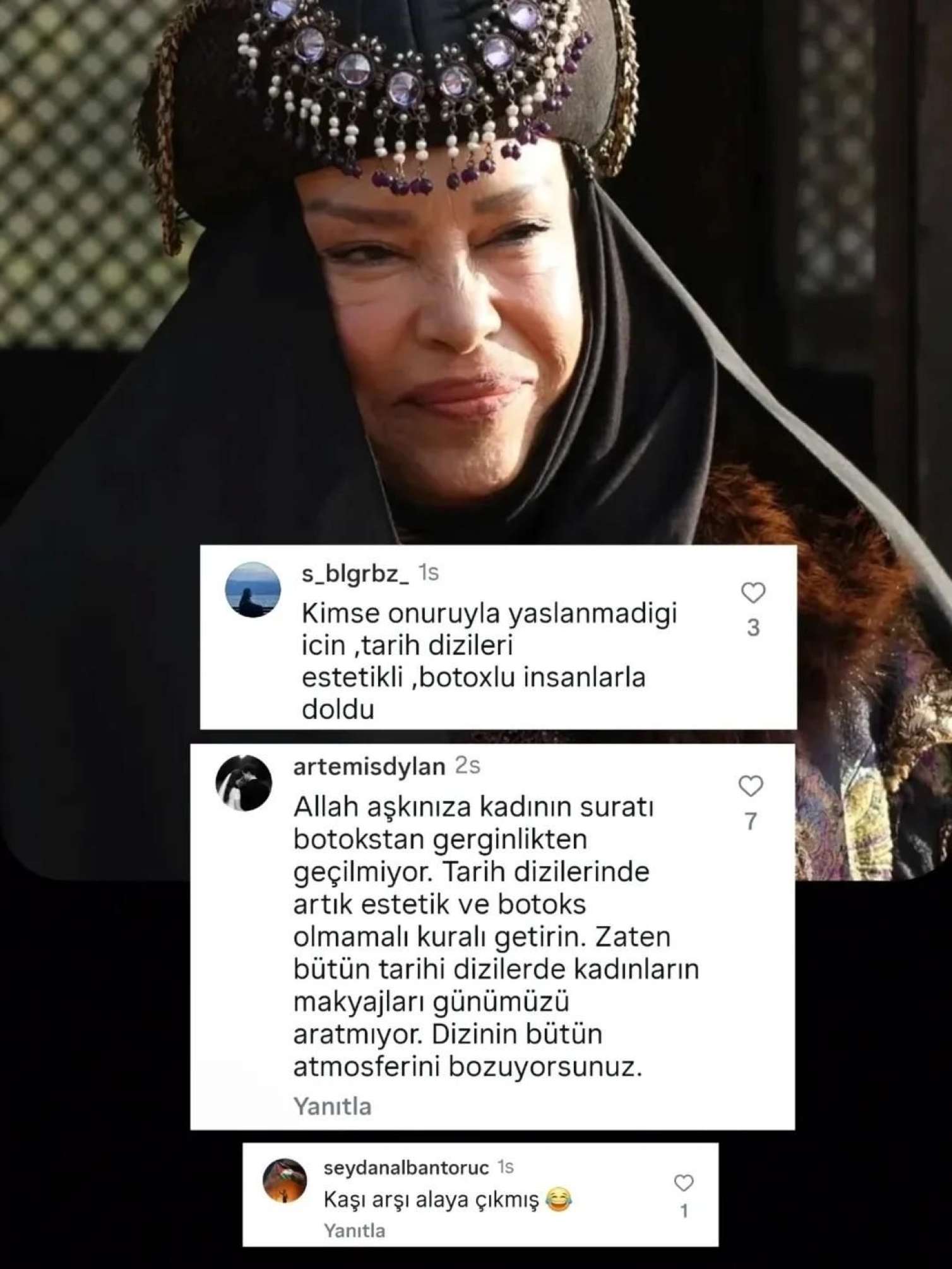 İndi də "Sara xatun"la bağlı mübahisə yarandı: Botoksları... – FOTO 