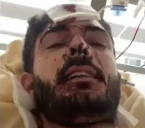 Fransada Məhəmməd Mirzəliyə hücum etmiş 4 nəfər həbs edildi 