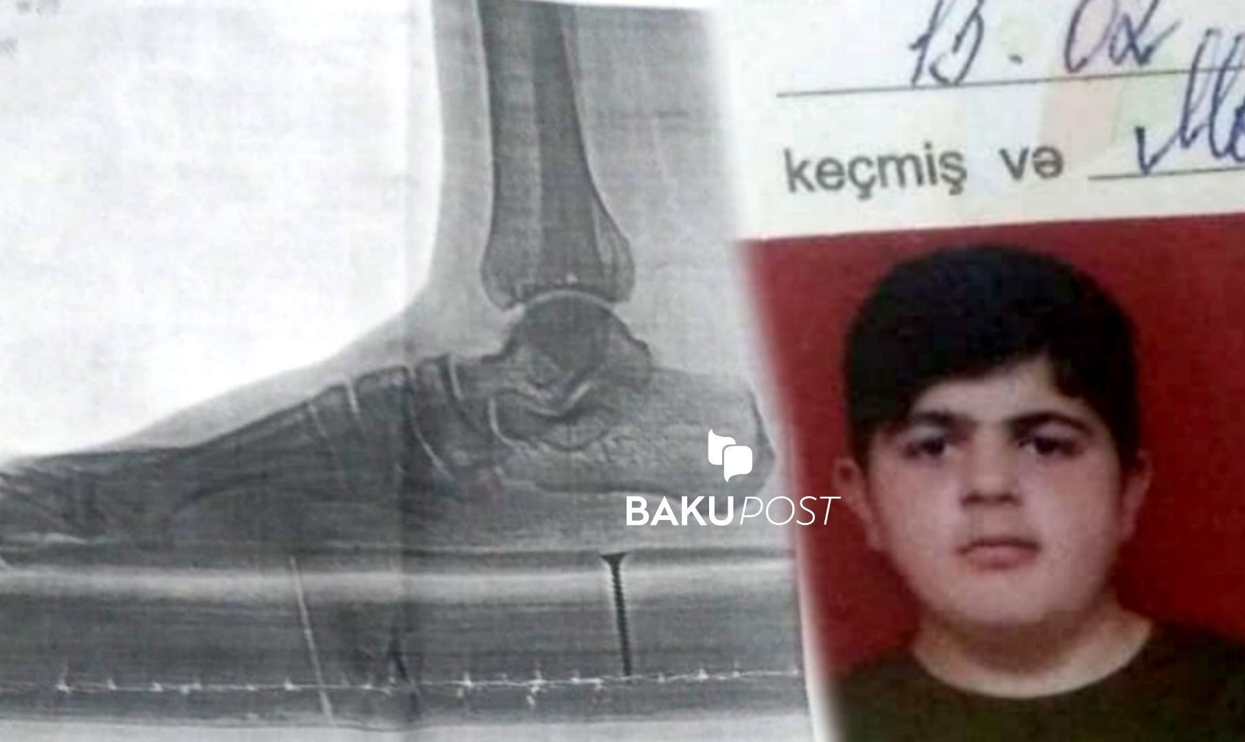 Hərbiyə yararsız adamı əsgər aparırlar – Mayor saxta sənəd